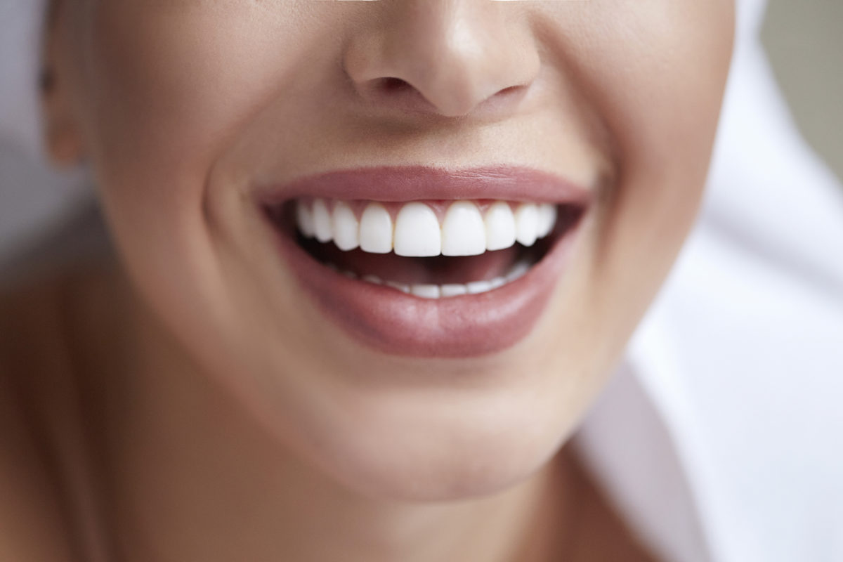 Crowns & Veneers Dentist Thousand Oaks | A Brilliant Smile ... Crowns & Veneers Dentist Thousand Oaks | A Brilliant Smile ...